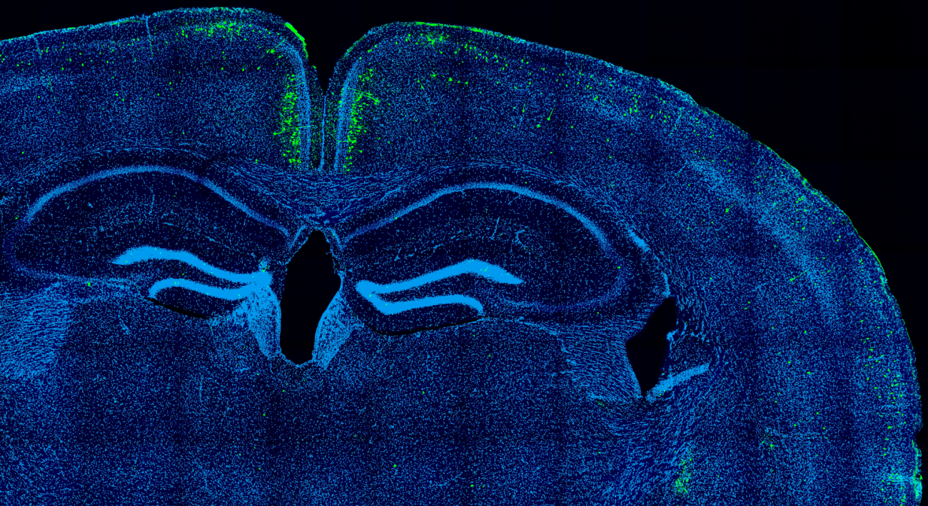 Chicken regulatory DNA sequence activating gene expression in mouse brain neurons, as predicted by the deep learning models