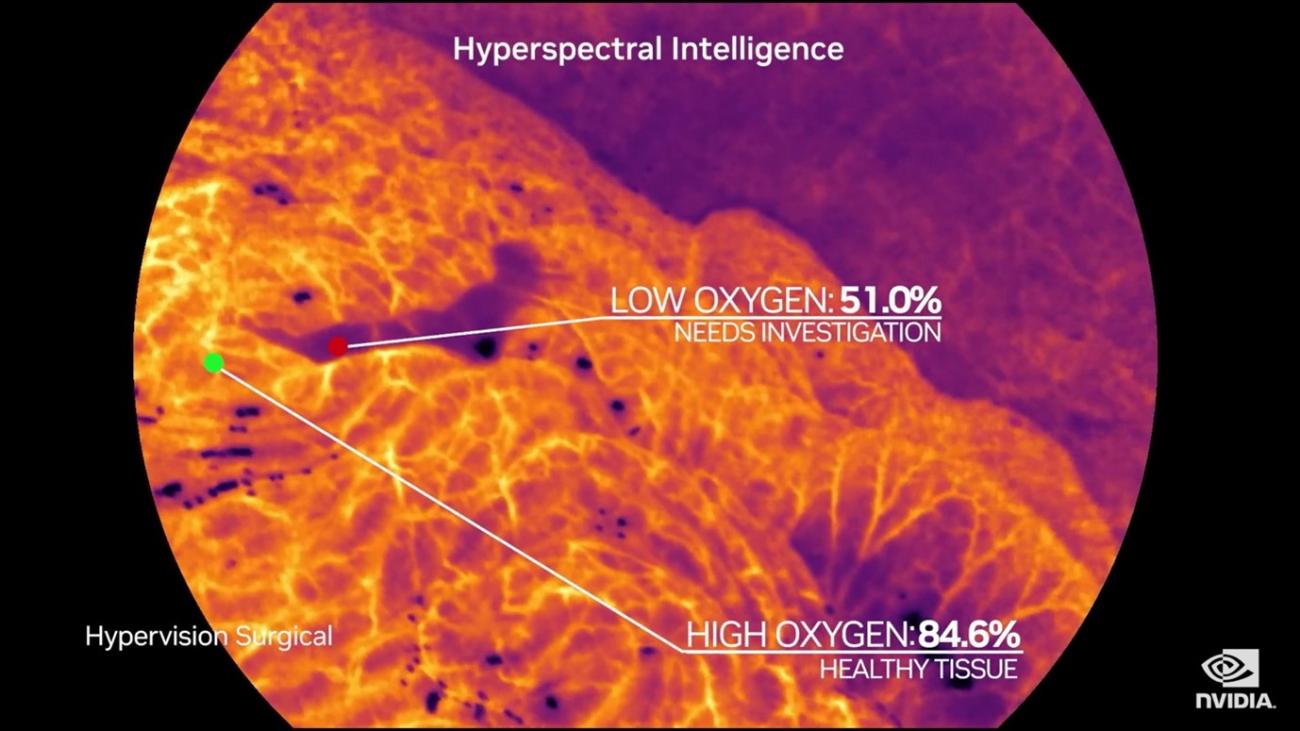 HERAN Partners co-leads the GBP 6,5m financing round of Hypervision Surgical to support the further development and commercial roll-out of their Hyperspectral Imaging platform HERAN Partners co-leads the GBP 6,5m financing round of Hypervision Surgical to support the further development and commercial roll-out of their Hyperspectral Imaging platform