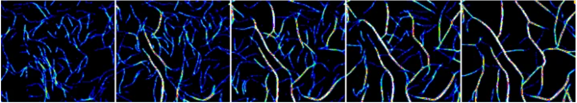 New protein function could explain cause of neurological disease