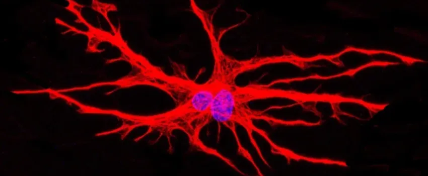 New model identifies key player in ALS
